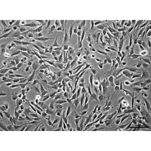 PureStem SK11, NCr-fac Progenitor Cells