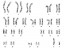 Karyogram of ESI-049 at passage 17 displays a normal karyotype (46, XY).
