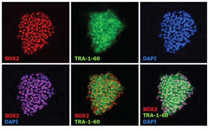 Expression of the pluripotent markers, Sox2 and Tra-1-60 in ESI-017,