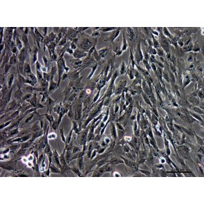PureStem ES-209, Meso-prx/latp Progenitor Cells
